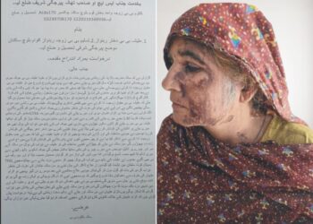 پیر جگی شریف: گھریلو تنازع پر بہو کا مبینہ تیزاب حملہ، ساس کا چہرہ 50 فیصد جھلس گیا