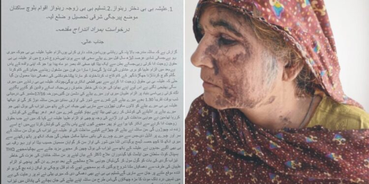 پیر جگی شریف: گھریلو تنازع پر بہو کا مبینہ تیزاب حملہ، ساس کا چہرہ 50 فیصد جھلس گیا